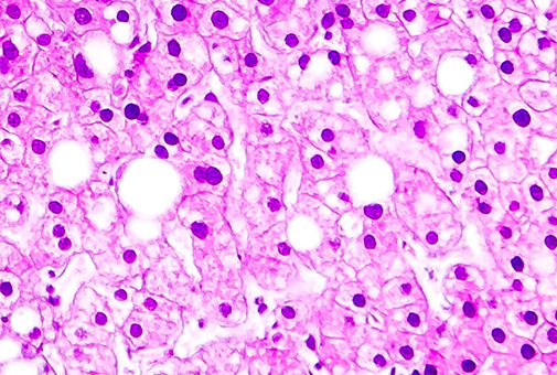 Histopathology